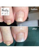 パスリー ネイルアンドケア(Parsley Nail&Care)/巻き爪補正は事前にご確認下さい