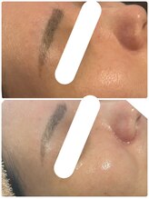 エルール トータルビューティ(Aileure total beauty)/ララピール×Wax