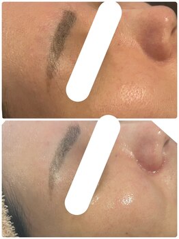 エルール トータルビューティ(Aileure total beauty)/ララピール×Wax