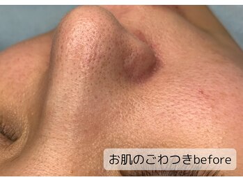 シェリール(Cherir)/肌質改善ベーシック