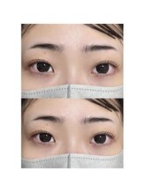 バニーアイズ 天神(Bunny eyes TENJIN)/パリジェンヌ×下まつげパーマ