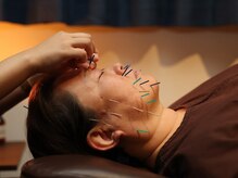 ウェルクス 本町院(Welux)/★エラ張りや食いしばりに集中