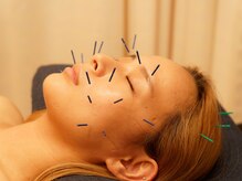 ねむのき鍼灸整骨院