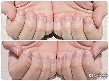 ネイルサロン きのこ