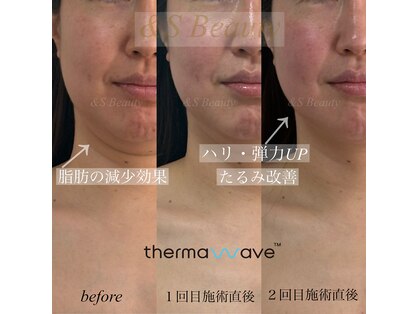 アンドエスビューティ(&S Beauty)の写真
