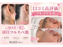 アルゴ 熊本宇土店(ALGO)の雰囲気(【美肌脱毛専門店】の脱毛×フェイシャルで本気の肌質改善)