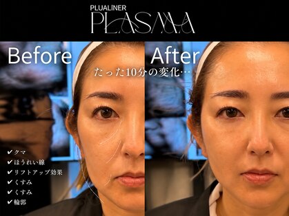 ラヴィ(Ravi)の写真