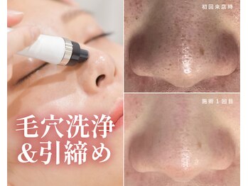 ハーボプラス(THE HEARBO plus)の写真/【黒ずみ/毛穴の開きを解消！毛穴レスを実感】毛穴洗浄×プラズマフェイシャルでつるんと美肌♪90分6980円