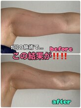 ルミネ(Lumine)/最強コラボで夏対策を！