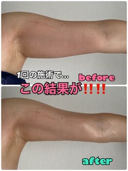 ルミネ(Lumine)/最強コラボで夏対策を！