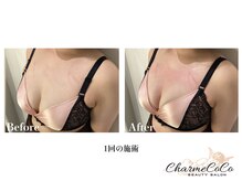 シャルムココ 蔵前店(CharmeCoCo)/お客様Before→After