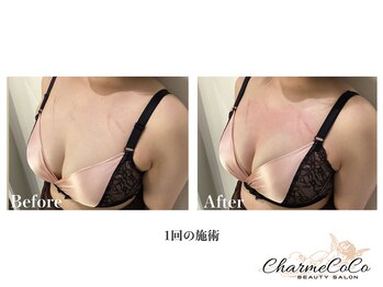 シャルムココ 蔵前店(CharmeCoCo)/お客様Before→After