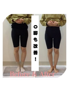 スタイルラボ高松/産後骨盤矯正の効果♪