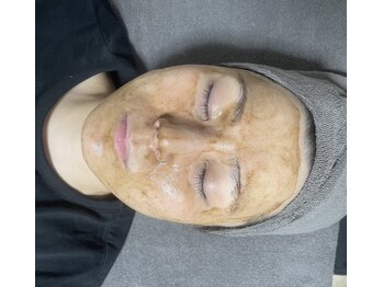 サロンエン(salon Enn)/エクソソームハーブピーリング