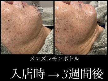 ビーエルティー(blt)/メンズレモンボトル