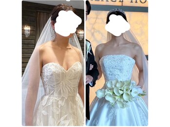 パルティール 銀座店 partir/4ヶ月の効果【ブライダル】