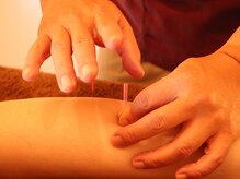 鍼灸整体ととのう 別府本院/