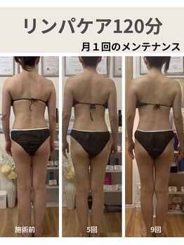 リア(Lia)/40代女性月1回のメンテナンス