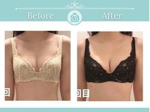 美人バスト 新潟店/ 【バストアップ★育乳】症例
