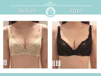 美人バスト 新潟店/ 【バストアップ★育乳】症例