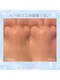 Pluien大阪堀江【韓国肌管理／毛穴洗浄／毛穴ケア／毛穴／小顔／ピーリング】の写真/毛穴洗浄で黒ずみ毛穴・角栓・つまり毛穴・開き毛穴を徹底ケア！キュッと引き締まった毛穴レスな水光肌へ♪
