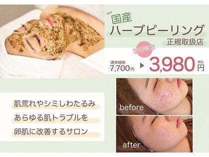 エピシア(Epicia)の写真