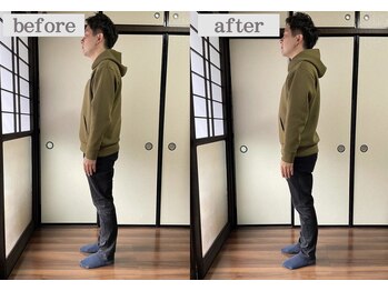 ミントのかべの整体院/姿勢矯正ビフォーアフター