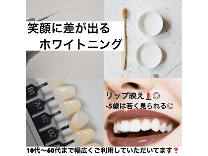 シャイニー(shiny)の写真