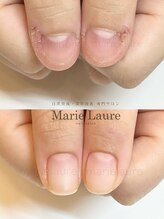 マリーロール 梅田店(Marie Laure)/深爪矯正/自爪育成/自爪風