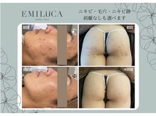 エミルカ 自由が丘店(EMILUCA)