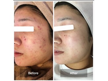 キッカ 梅田天六(Kikka)