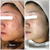 キッカ 梅田天六(Kikka)