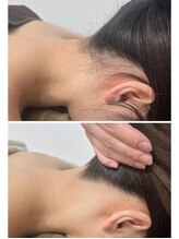 ミース 北九州店/うなじ●ビフォーアフター