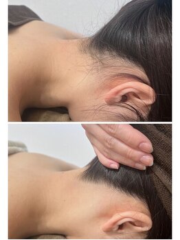 ミース 北九州店/うなじ●ビフォーアフター