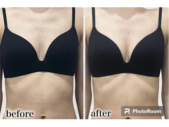 エステティック レイビス 八戸店(RAYVIS)/バストケア♪ブライダルの方にも