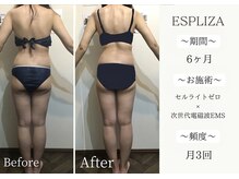 エスプライザ 横浜駅前店の雰囲気（短い期間でしっかり結果だし！！全身ケアもお任せください♪）