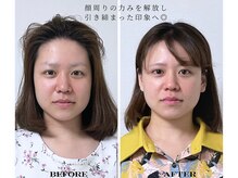 ミラ 長崎駅前店(MIRA)/小顔矯正#長崎市#浦上駅_小顔