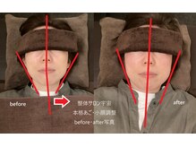 整体サロン宇宙/☆本格あご・小顔矯正☆