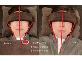 整体サロン宇宙/☆本格あご・小顔矯正☆