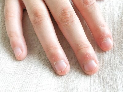 お爪にお悩みがある方、育成技術で見違えるようなお爪に導きます
