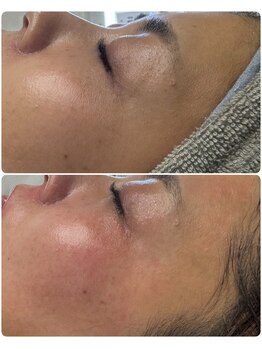 エミニー(Eminy)/ワックス×プラズマ