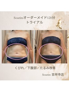 スリール 吉祥寺店(Sourire)/60代お腹たるみ改善効果