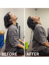 シナプスケアセンター 十三院(SYNAPSE CARE CENTER)/【シナプス療法】で姿勢改善！