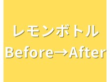 イーラボ 池袋店(e-LABO)/レモンボトル+ラジオ波Lift