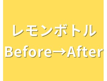 イーラボ 池袋店(e-LABO)/レモンボトル+ラジオ波Lift