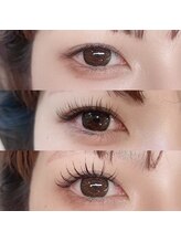 ステラ 松戸店(STELLA)/アンドヘルシービフォーアフター