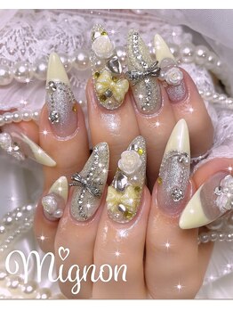 ミニョン 新宿(Mignon)/ワンホンネイル/ガーリーネイル