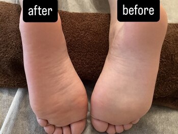 サロンリアン(salon Lien)/◇足裏のむくみもスッキリ！◇