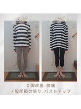 りもあず(ReMore-S)/諦めていたO脚も骨ケアで整う