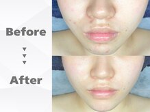 アンドミー 中百舌鳥(&me)